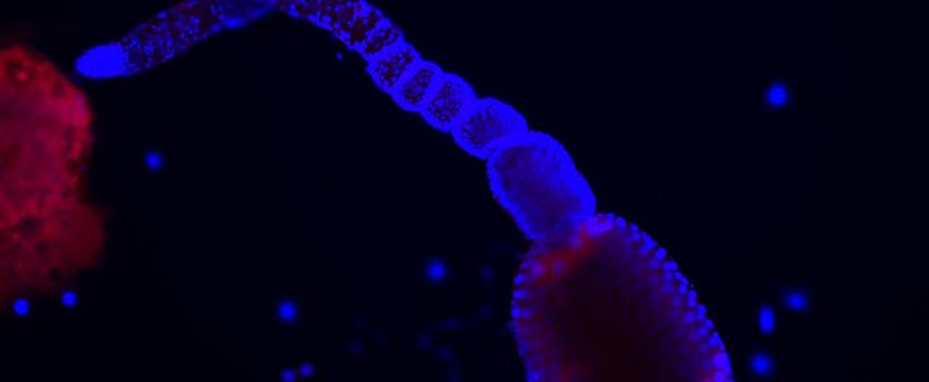 解剖猫蚤卵巢. 染成蓝色(细胞核)和红色(跳蚤组织)的标本. 用荧光显微镜观察.