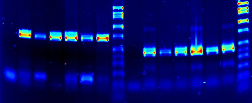 光谱增强(假色)琼脂糖凝胶DNA图片.