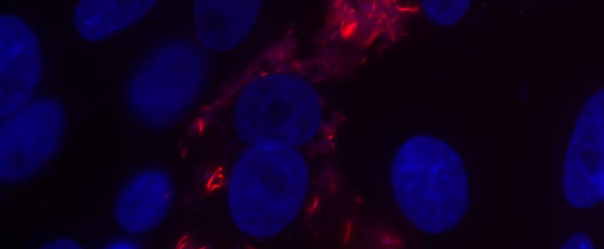 宿主细胞内(蓝色细胞核)胞内细菌(红色)的荧光显微镜.