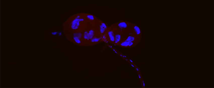 解剖猫蚤唾液腺. 染成蓝色(细胞核)和红色(跳蚤组织)的标本. 用荧光显微镜观察.